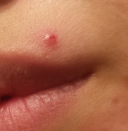 2017-03-11 06.51.20.jpg