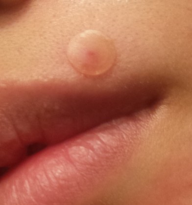 2017-03-11 06.52.33.jpg