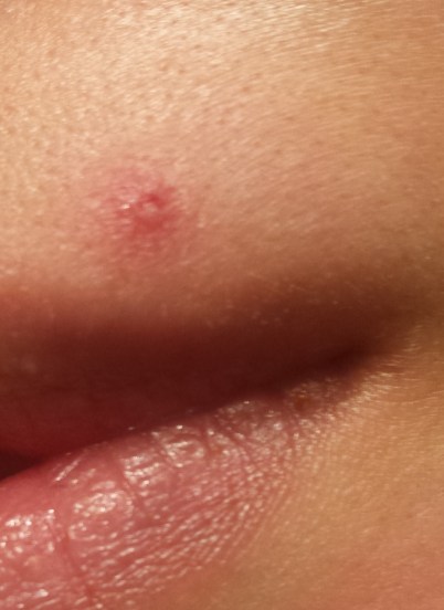 2017-03-11 08.19.05.jpg