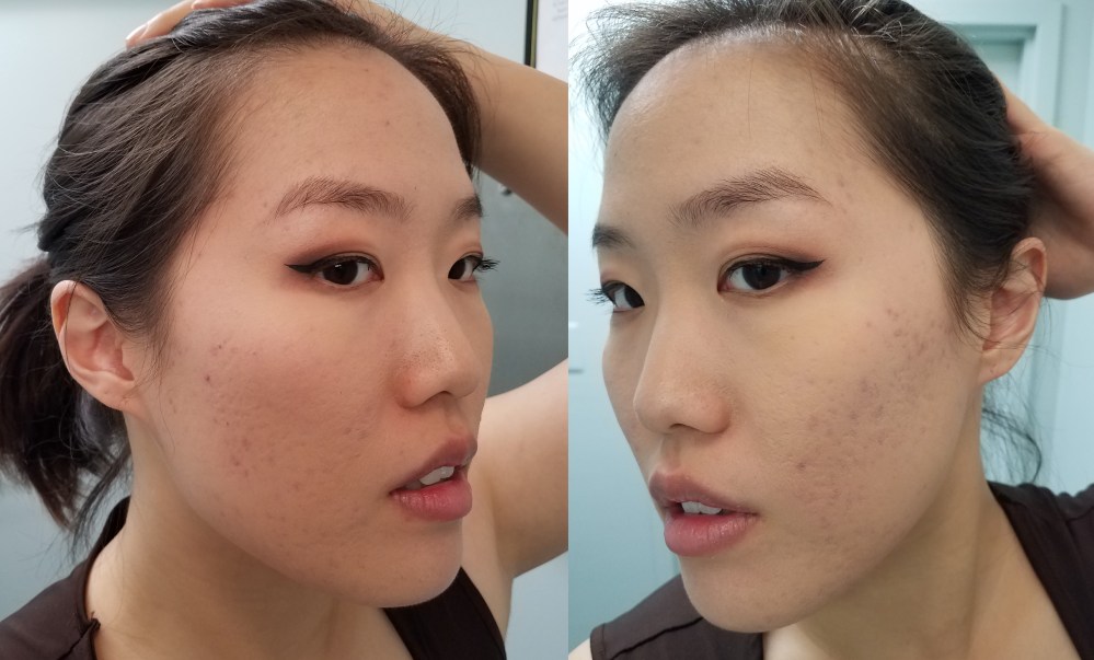 2. First check in.jpg